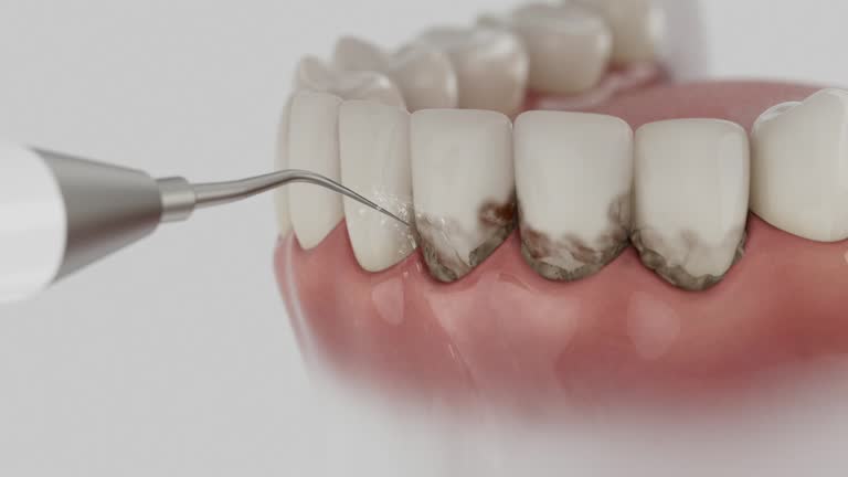 Trusted Teeth Cleaning And Checkup service in Grandview, OH - Dentist Open Now